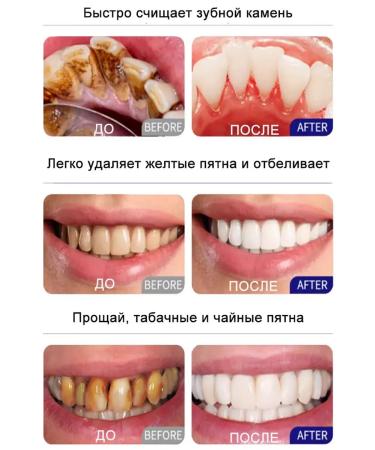 LYDIMOON Lemongrass tooth Chinese toothpaste - Buy Online on GoSupps.com