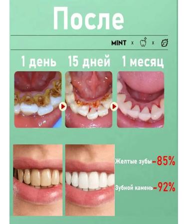 LYDIMOON Lemongrass tooth Chinese toothpaste - Buy Online on GoSupps.com