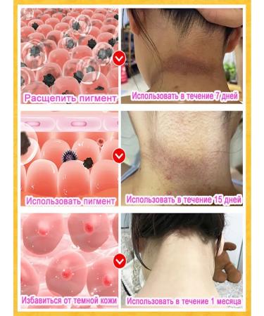 LYDIMOON Lightening underarm cream - Buy Online on GoSupps.com