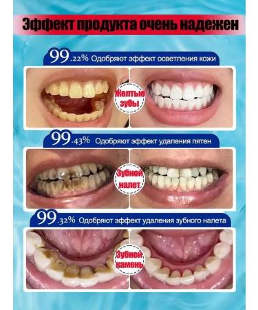 DRSKINVITA 100 g of toothpaste for removing spots from coffee and tea - Buy Online on GoSupps.com