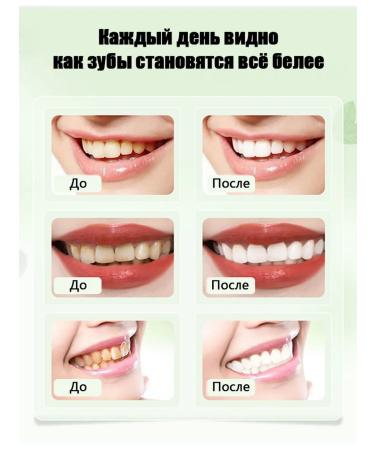 LYDIMOON Whitening toothpaste Professional with a dispenser - Buy Online on GoSupps.com