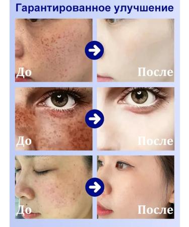 DRSKINVITA Whitening face cream from pigmentation and freckles 20 g - Buy Online on GoSupps.com