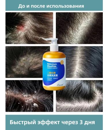 DRSKINVITA Shampoo against dandruff with selenium disulfide 300 ml - Buy Online on GoSupps.com