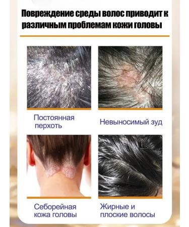 DRSKINVITA Shampoo against dandruff with selenium disulfide 300 ml - Buy Online on GoSupps.com
