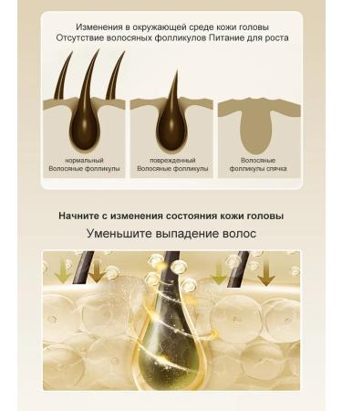 LiQT Shampoo against falling out of dandruff 500 ml - Buy Online on GoSupps.com