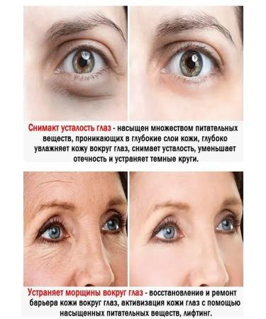 LYDIMOON Moisturizing eye cream against wrinkles - Buy Online on GoSupps.com