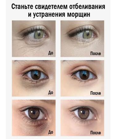 LYDIMOON Moisturizing eye cream against wrinkles - Buy Online on GoSupps.com