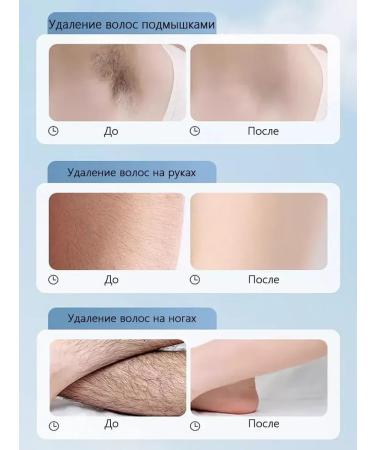 LYDIMOON Cream for intimate zones - Buy Online on GoSupps.com