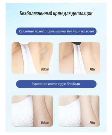 LYDIMOON Cream for intimate zones - Buy Online on GoSupps.com