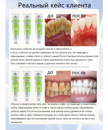 LYDIMOON Whitening toothpaste with probiotics - Buy Online on GoSupps.com