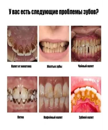 LYDIMOON Whitening toothpaste with probiotics - Buy Online on GoSupps.com