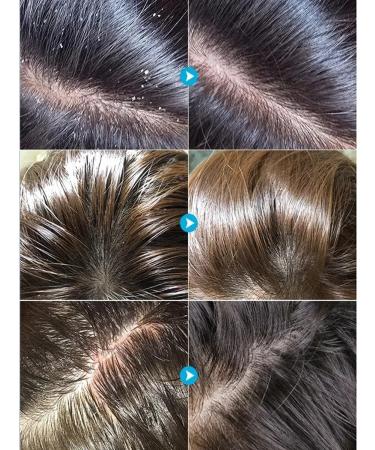 LYDIMOON Cleansing shampoo against dandruff and fat content of 500 ml - Buy Online on GoSupps.com