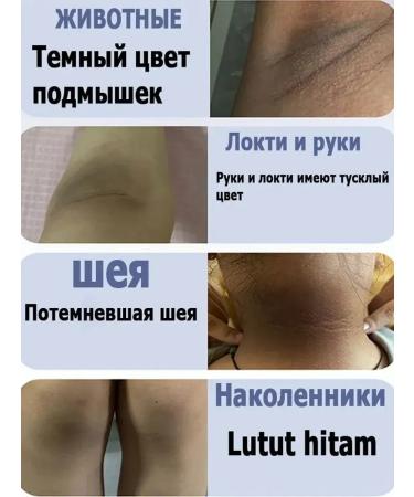 Supervision for armpits Private bleaching cream - Buy Online on GoSupps.com