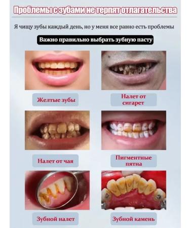 LYDIMOON Cleaning toothpaste for bleaching - Buy Online on GoSupps.com