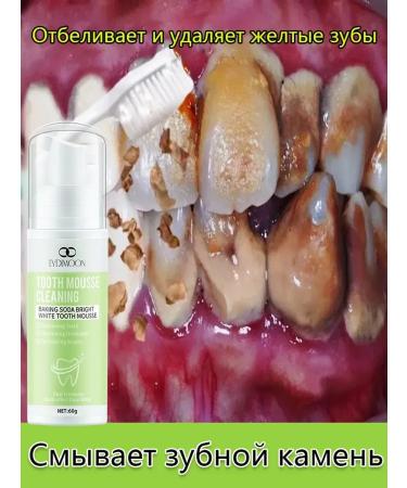 LYDIMOON Oral cleansing mousse