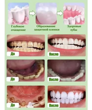 LYDIMOON Oral cleansing mousse - Buy Online on GoSupps.com