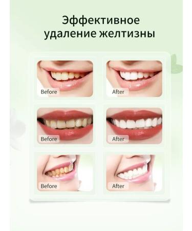 LYDIMOON Oral cleansing mousse - Buy Online on GoSupps.com