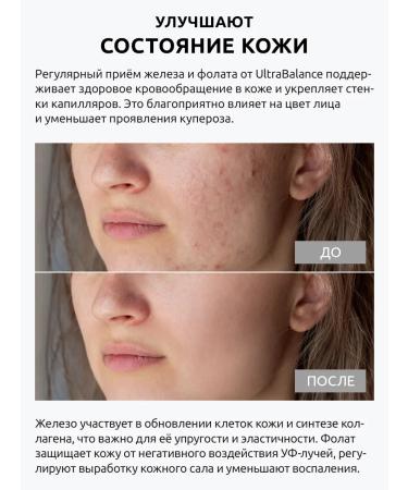 UltraBalance Complex folat iron vitamins for women - Buy Online on GoSupps.com