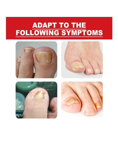 Nail care cream (10 ml) - Buy Online on GoSupps.com