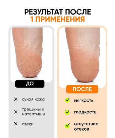 Feet cream and arms from cracks and dryness 50g - Buy Online on GoSupps.com