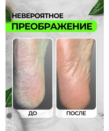 Mulsan A product for smooth heels Keratolytic 600 ml - Buy Online on GoSupps.com