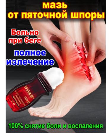 Chinese ointment from the heel spurs in heels 30 r