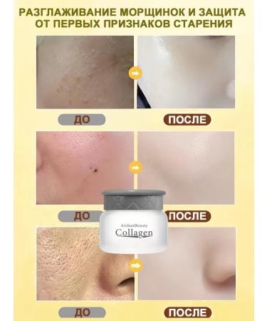 DRSKINVITA 80 g moisturizing bleaching cream with snail collagen - Buy Online on GoSupps.com