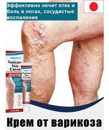 Cream from varicose veins 20g relieves pain and swelling