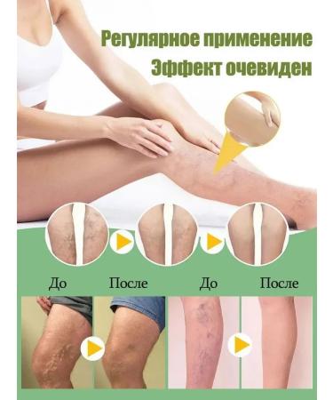 Cream from varicose veins 20g relieves pain and swelling - Buy Online on GoSupps.com