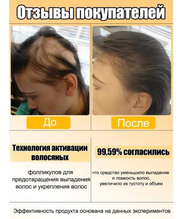 LYDIMOON Women's hair shampoo from dandruff for growth - Buy Online on GoSupps.com