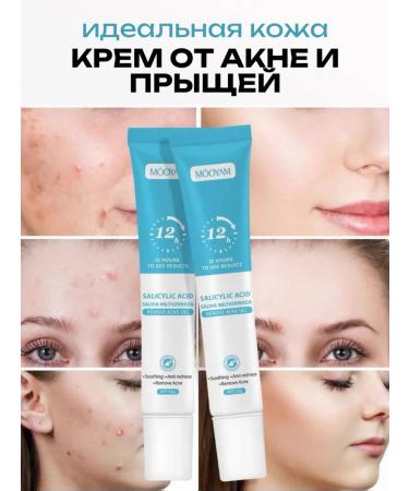 Cosmetics box Cream from acne zinc and niacinamide 20ml