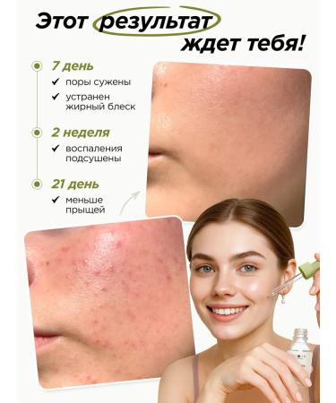 MIXIT Herbity for the face moisturizing from acne and washing gel - Buy Online on GoSupps.com