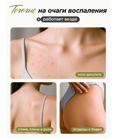 MIXIT Herbity for the face moisturizing from acne and washing gel - Buy Online on GoSupps.com