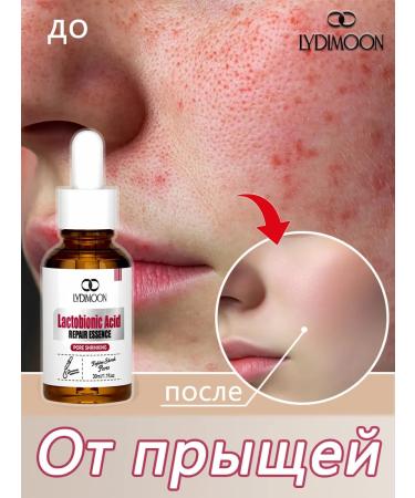 LYDIMOON Pimpling sera with lactobionic acid