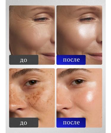 Althea Retinait Anti-Wrinkle Facial Serum with Retinol - Buy Online on GoSupps.com