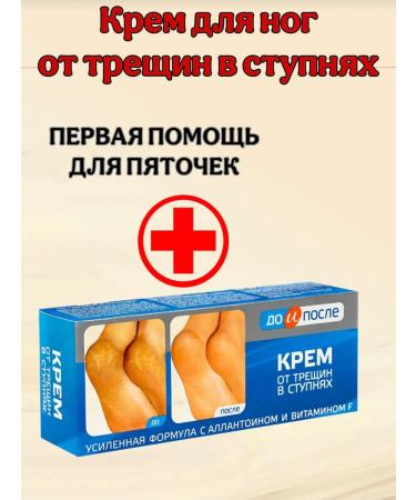 Feet cream from cracks on the feet and heels
