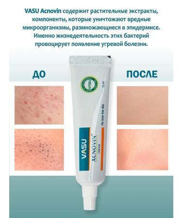 VASU Facial cream from acne 3 pcs - Buy Online on GoSupps.com