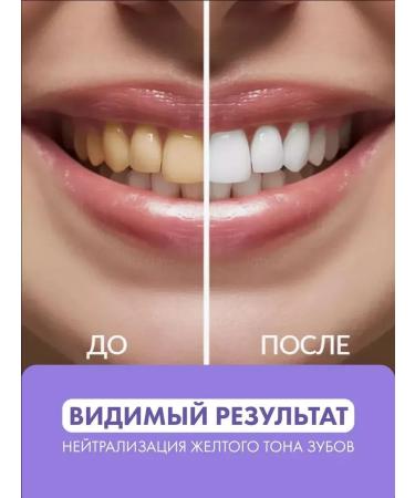 DRSKINVITA V34 toothpaste for bleaching and removal of smoke 30 ml - Buy Online on GoSupps.com