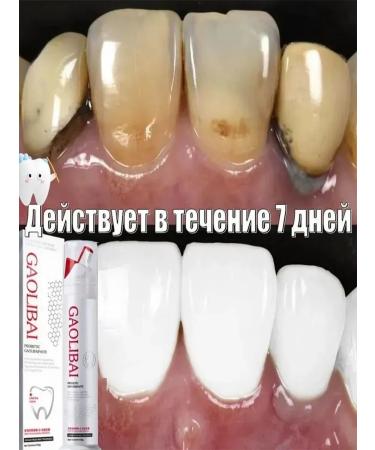 Toothpaste whitening without fluorine