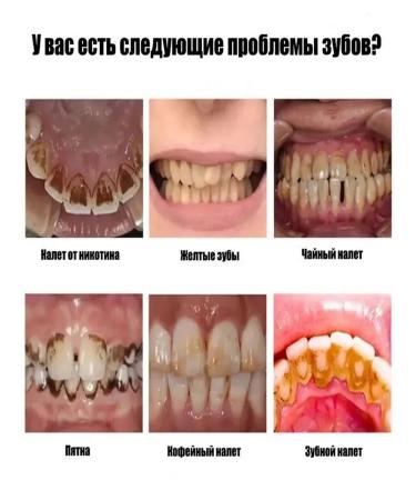 Toothpaste whitening without fluorine - Buy Online on GoSupps.com