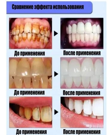 Toothpaste whitening without fluorine - Buy Online on GoSupps.com