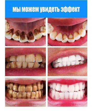Toothpaste whitening without fluorine - Buy Online on GoSupps.com