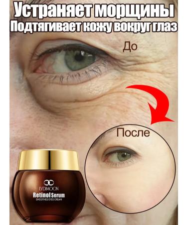 LYDIMOON Skin cream around the eyes anti -aging from wrinkles 35g