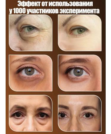 LYDIMOON Skin cream around the eyes anti -aging from wrinkles 35g - Buy Online on GoSupps.com