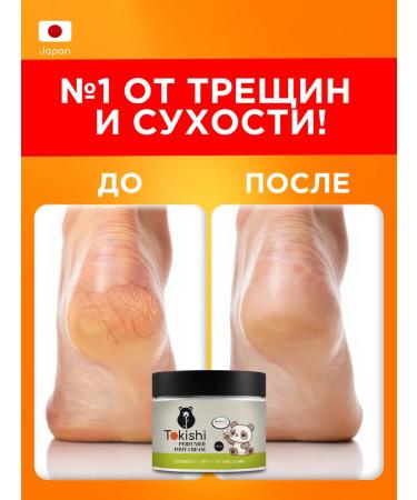 TOKISHI SB Cream for the legs with urea from cracks