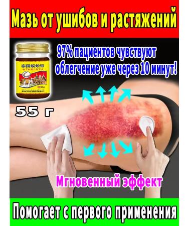 Bruises and sprains 55g