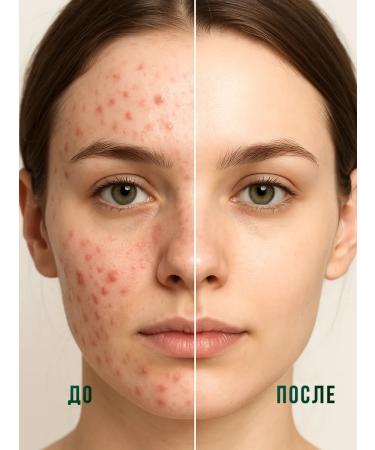 Mesomatrix Professional Cleaning tonic and face gel - Buy Online on GoSupps.com