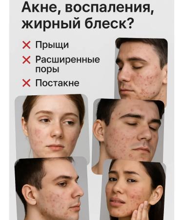 COME 3 Acne cream and acne on the face - Buy Online on GoSupps.com