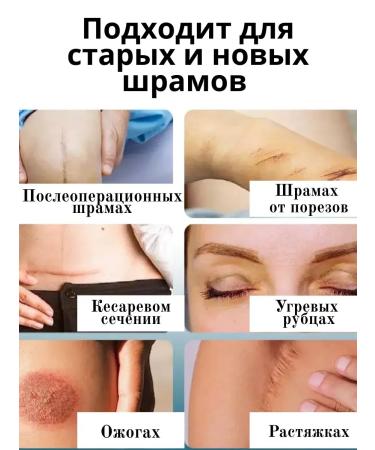 BAYBOLOM Ointment from scars and scars on the skin on the face - Buy Online on GoSupps.com