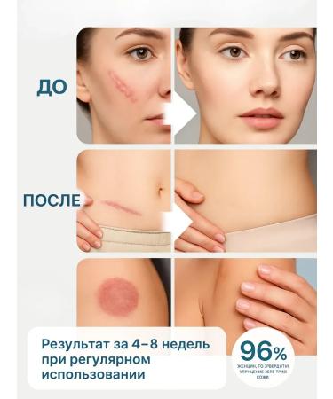 BAYBOLOM Ointment from scars and scars on the skin on the face - Buy Online on GoSupps.com